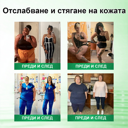 👩 𝐴𝑁𝐺𝐸𝐿𝑇𝑅𝐴𝑃® 𝐌𝐨𝐫𝐢𝐧𝐠𝐚 × 𝐁𝐞𝐫𝐛𝐞𝐫𝐲𝐧𝐚 × 𝐀𝐌𝐏𝐊 𝟏𝟎 в 𝟏 – Нано микроиглен пластир за отслабване|Само 𝟏× дневно ✅ Видими промени за 𝟕 дни – при затлъстяване, сърдечно-съдово здраве, диабет и ставни проблеми