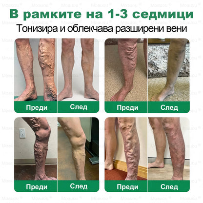 ⏰ Честито! Отворихте ексклузивна оферта за Moauou®! За поръчката ви днес предлагаме допълнителна 50% отстъпка! Кликнете на линка по-долу, за да се възползвате от тази специална оферта, която скоро изтича! ⏰