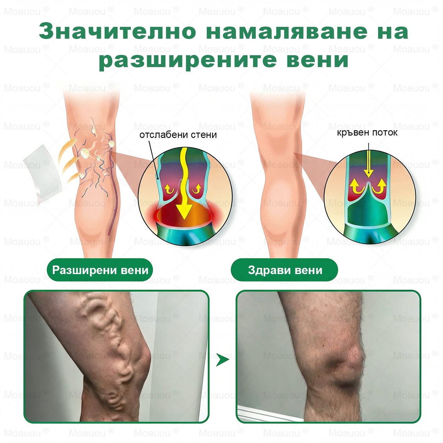 ⏰ Честито! Отворихте ексклузивна оферта за Moauou®! За поръчката ви днес предлагаме допълнителна 50% отстъпка! Кликнете на линка по-долу, за да се възползвате от тази специална оферта, която скоро изтича! ⏰