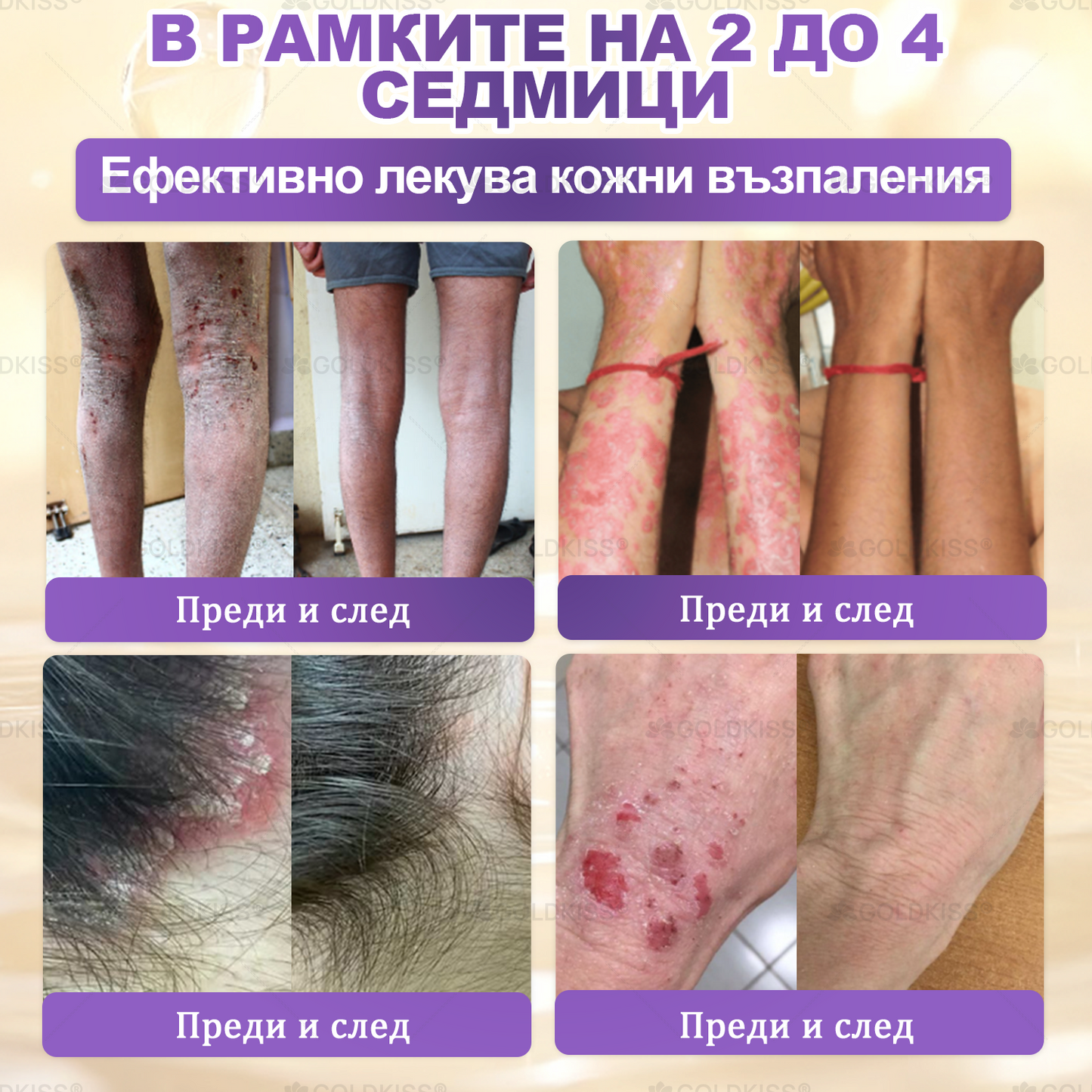 Произведено и изпратено от Европа ✨ 𝐆𝐎𝐋𝐃𝐊𝐈𝐒𝐒® 𝐆𝐇𝐊-𝐂𝐮 & 𝐁𝐈𝐎𝐓𝐈𝐍 𝟏𝟎-𝐁-𝟏 Възстановяващ крем за кожата ⚡