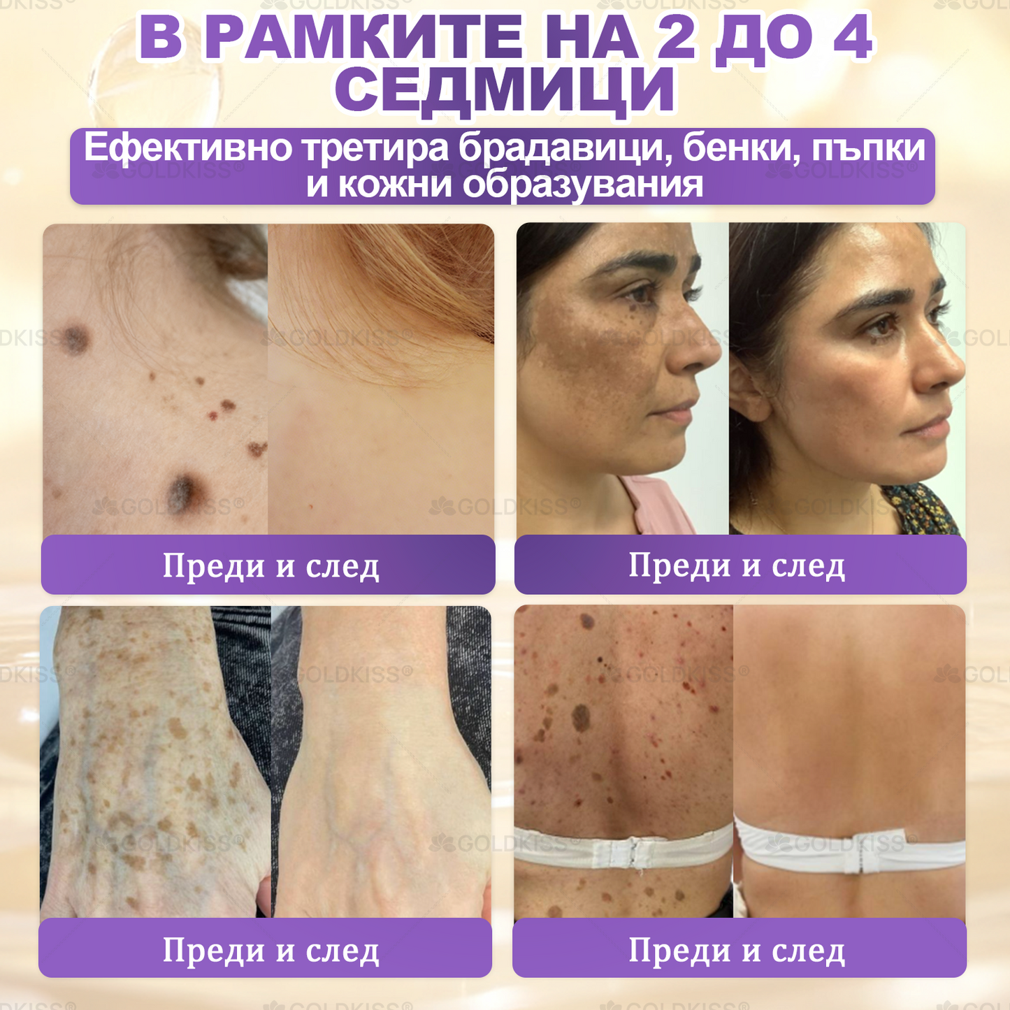 Произведено и изпратено от Европа ✨ 𝐆𝐎𝐋𝐃𝐊𝐈𝐒𝐒® 𝐆𝐇𝐊-𝐂𝐮 & 𝐁𝐈𝐎𝐓𝐈𝐍 𝟏𝟎-𝐁-𝟏 Възстановяващ крем за кожата ⚡
